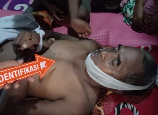 Pria Paruh Baya di Dompu Tewas Disambar Petir